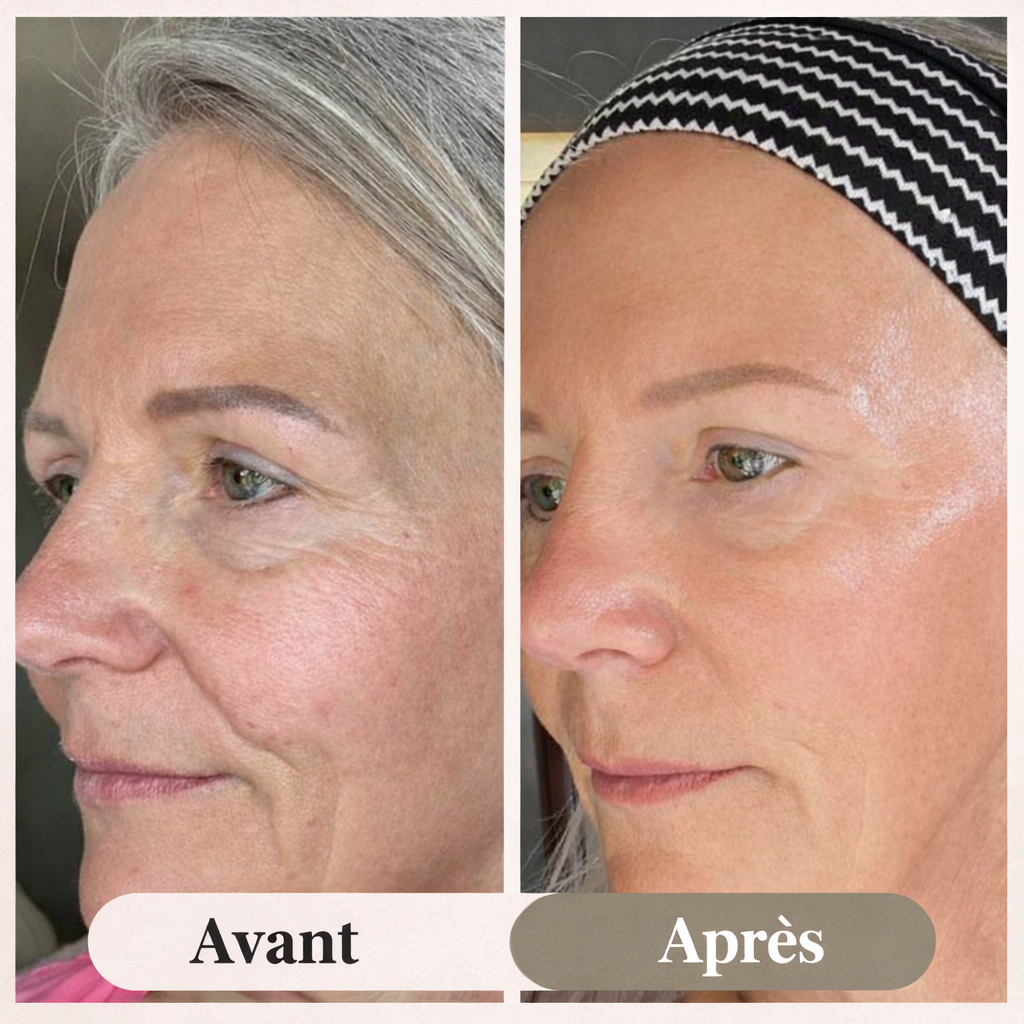 LE PACK RITUEL SKYNE®